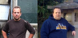 Photo d'un homme avant et après une sleeve gastrique.