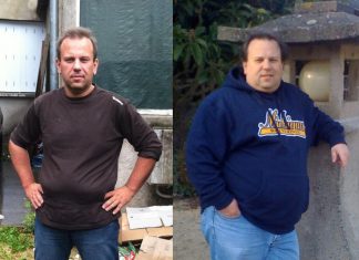 Photo d'un homme avant et après une sleeve gastrique.