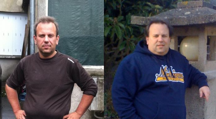 Photo d'un homme avant et après une sleeve gastrique.