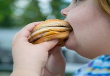 Une femme en obésité